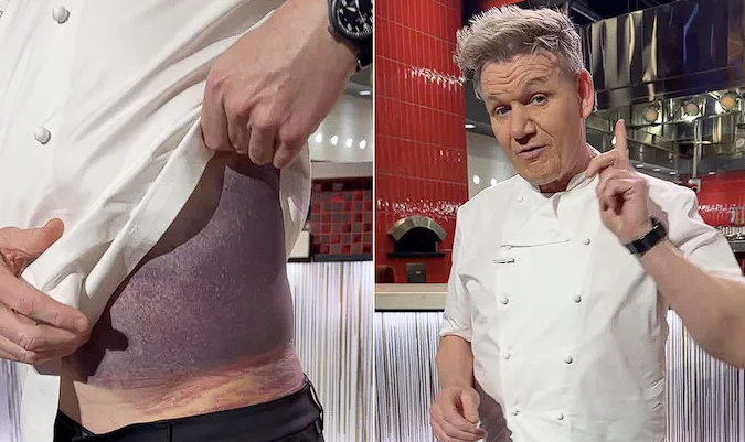 “I’m Lucky To Be Here”: Gordon Ramsay Flooded With Recovery Wishes After Harrowing Accident