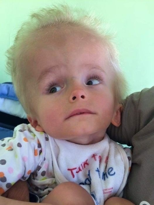 Mom gives up baby because of his head – 4 yrs later, there’s a knock on the orphanage door