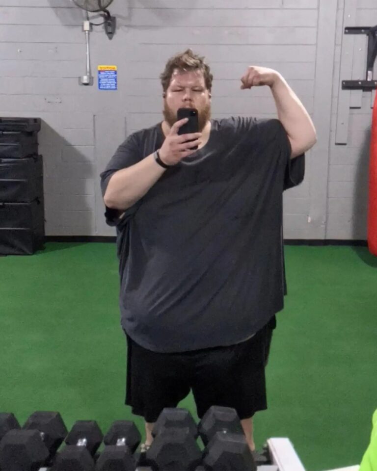 Man Receives Overwhelming Support After Losing An Incredible 336lbs