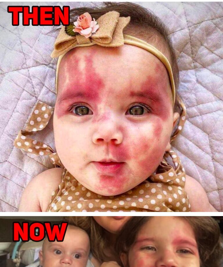 They Called The Baby Hideous But Wait Till You See Her Now