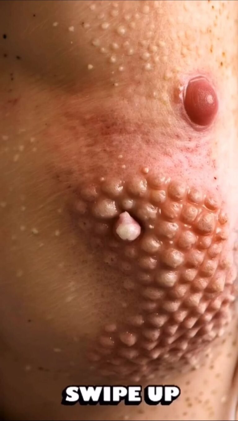 Disturbing Skin Condition Leaves Viewers Speechless
