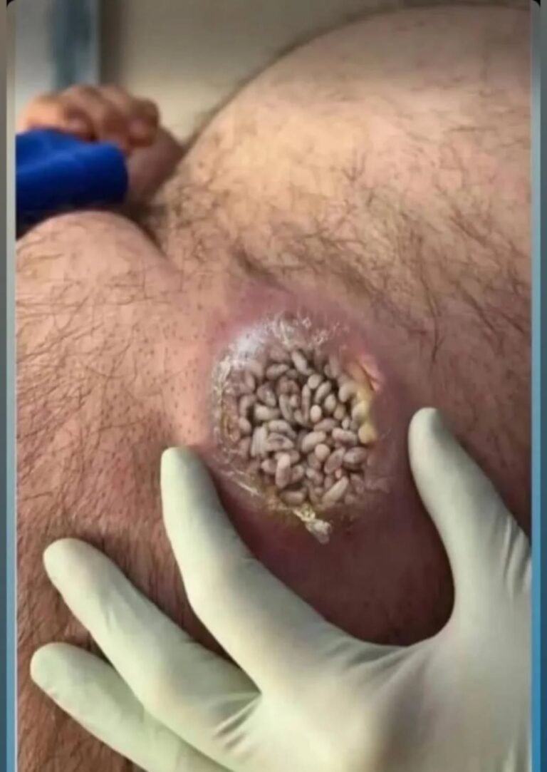 8 Alarming Skin Signs You Can’t Ignore