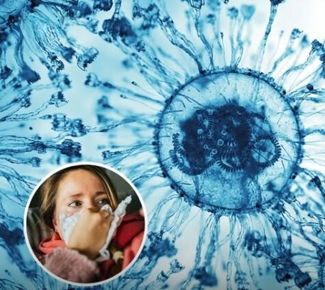Doctors reveal unusual symptoms of new Covid variants ‘Stratus’ and ‘Nimbus’ that are sweeping the US